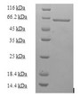 (Tris-Glycine gel) Discontinuous SDS-PAGE (reduced) with 5% enrichment gel and 15% separation gel.