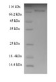 
(Tris-Glycine gel) Discontinuous SDS-PAGE (reduced) with 5% enrichment gel and 15% separation gel.