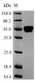 (Tris-Glycine gel) Discontinuous SDS-PAGE (reduced) with 5% enrichment gel and 15% separation gel.