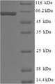 (Tris-Glycine gel) Discontinuous SDS-PAGE (reduced) with 5% enrichment gel and 15% separation gel.