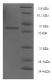 (Tris-Glycine gel) Discontinuous SDS-PAGE (reduced) with 5% enrichment gel and 15% separation gel.