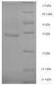 (Tris-Glycine gel) Discontinuous SDS-PAGE (reduced) with 5% enrichment gel and 15% separation gel.