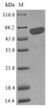 
(Tris-Glycine gel) Discontinuous SDS-PAGE (reduced) with 5% enrichment gel and 15% separation gel.