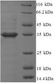 (Tris-Glycine gel) Discontinuous SDS-PAGE (reduced) with 5% enrichment gel and 15% separation gel.