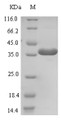 (Tris-Glycine gel) Discontinuous SDS-PAGE (reduced) with 5% enrichment gel and 15% separation gel.