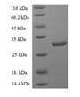 (Tris-Glycine gel) Discontinuous SDS-PAGE (reduced) with 5% enrichment gel and 15% separation gel.