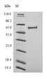 (Tris-Glycine gel) Discontinuous SDS-PAGE (reduced) with 5% enrichment gel and 15% separation gel.