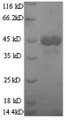 
(Tris-Glycine gel) Discontinuous SDS-PAGE (reduced) with 5% enrichment gel and 15% separation gel.