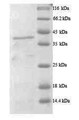 (Tris-Glycine gel) Discontinuous SDS-PAGE (reduced) with 5% enrichment gel and 15% separation gel.