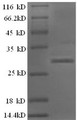 (Tris-Glycine gel) Discontinuous SDS-PAGE (reduced) with 5% enrichment gel and 15% separation gel.