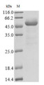 (Tris-Glycine gel) Discontinuous SDS-PAGE (reduced) with 5% enrichment gel and 15% separation gel.