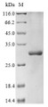 (Tris-Glycine gel) Discontinuous SDS-PAGE (reduced) with 5% enrichment gel and 15% separation gel.