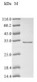 (Tris-Glycine gel) Discontinuous SDS-PAGE (reduced) with 5% enrichment gel and 15% separation gel.