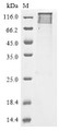 (Tris-Glycine gel) Discontinuous SDS-PAGE (reduced) with 5% enrichment gel and 15% separation gel.