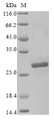 (Tris-Glycine gel) Discontinuous SDS-PAGE (reduced) with 5% enrichment gel and 15% separation gel.