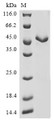 (Tris-Glycine gel) Discontinuous SDS-PAGE (reduced) with 5% enrichment gel and 15% separation gel.