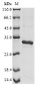 (Tris-Glycine gel) Discontinuous SDS-PAGE (reduced) with 5% enrichment gel and 15% separation gel.