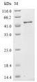 (Tris-Glycine gel) Discontinuous SDS-PAGE (reduced) with 5% enrichment gel and 15% separation gel.