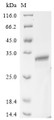 (Tris-Glycine gel) Discontinuous SDS-PAGE (reduced) with 5% enrichment gel and 15% separation gel.