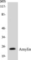 Western blot analysis of extracts from HeLa cells, treated with EGF 200ng/ml 30', using Amylin Antibody. 