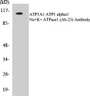 Western blot analyzes of Na+/K+-ATPase α1 antibody in extracts from A549 cells.