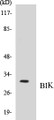 Western blot analysis of extracts from HuvEc/COLO205, using BIK (Ab-33) Antibody. 