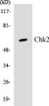 Western blot analysis of extracts from 293 cells treated with UV, using Chk2 (Ab-516) Antibody.