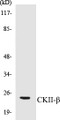 Western blot analysis of extracts from HuvEc cells, using CKII-beta (Ab-209) Antibody. 