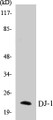 Western blot analysis of the lysates from HUVECcells using PARK7 antibody.