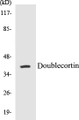 Western blot analysis of extracts from Jurkat cells, using Doublecortin (Ab-376) Antibody. 