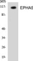 Western blot analysis of the lysates from HeLa cells using EPHA5 antibody.