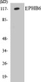 Western blot analysis of extracts from COLO/293/HeLa cells, using EPHB6 Antibody. 