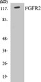 Western blot analysis of extracts from A549 cells, using FGFR2 Antibody. 