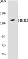 Western blot analysis of extracts from HepG2 cells, using EPHB1/2 (Ab-594/604) Antibody.