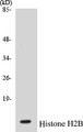 Western blot analysis of the lysates from HUVECcells using Histone H2B antibody.