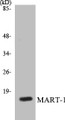 Western blot analysis of extracts from NIH-3T3 cells, using MART-1 Antibody. 