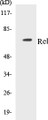 Western blot analysis of extracts from MDA-MB-435 cells, using Rel (Ab-503) Antibody. 