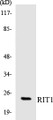 Western blot analysis of extracts from Jurkat cells, using RIT1 Antibody. 