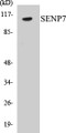 Western blot analysis of extracts from HuvEc cells, using SENP7 Antibody. 