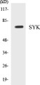 Western blot analysis of extracts from Jurkat cells, treated with UV 15', using SYK (Ab-348) Antibody. 