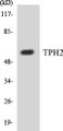 Western blot analysis of the lysates from HUVECcells using TPH2 antibody.