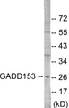 Western blot analysis of extracts from LOVO cells, treated with serum 10% 15’, using GADD153 Antibody.