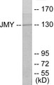 Western blot analysis of extracts from COLO cells, using JMY Antibody. The lane on the right is treated with the synthesized peptide.