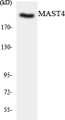 Western blot analysis of extracts from Jurkat/COLO/HuvEc/MCF-7 cells, using MAST4 Antibody.