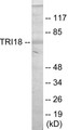 Western blot analysis of extracts from 293 cells, using TRI18 Antibody.