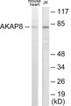Western blot analysis of extracts from mouse heart/Jurkat cells, using AKAP8 Antibody.