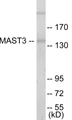 Western blot analysis of extracts from Jurkat cells, using MAST3 Antibody. The lane on the right is treated with the synthesized peptide.