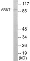 Western blot analysis of extracts from HepG2 cells, using ARNT Antibody. The lane on the right is treated with the synthesized peptide.