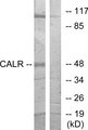 Western blot analysis of extracts from COS7 cells, using CALR Antibody.
