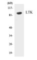 Western blot analysis of extracts from Jurkat cells, using LTK Antibody. The lane on the right is treated with the synthesized peptide.